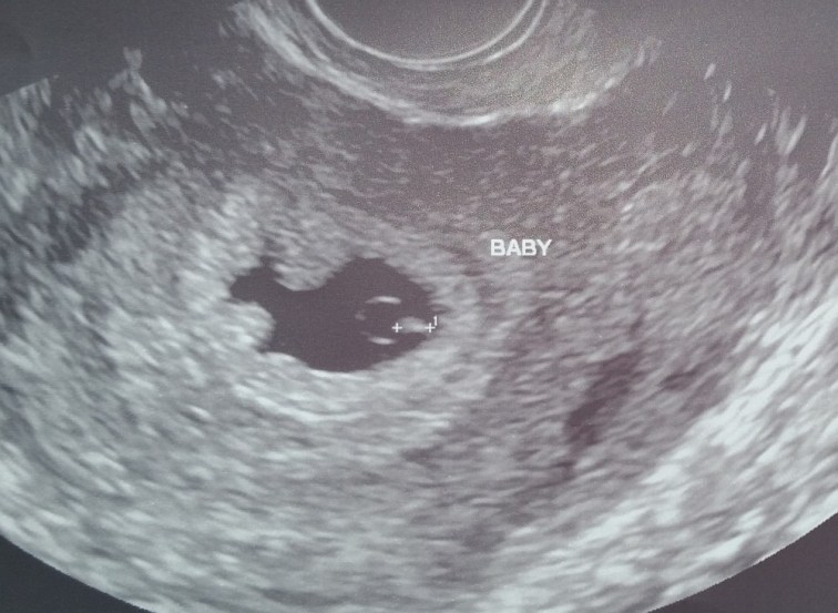 babyb